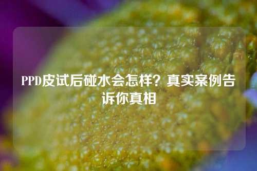 PPD皮试后碰水会怎样？真实案例告诉你真相